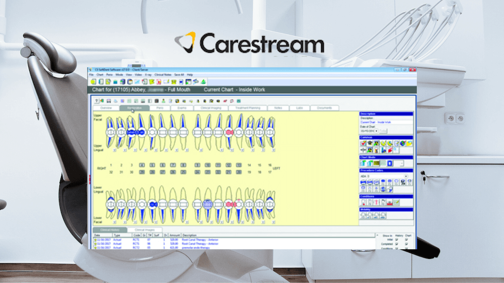 CS SoftDent Software